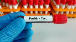 Increase Ferritin Levels with Supplements